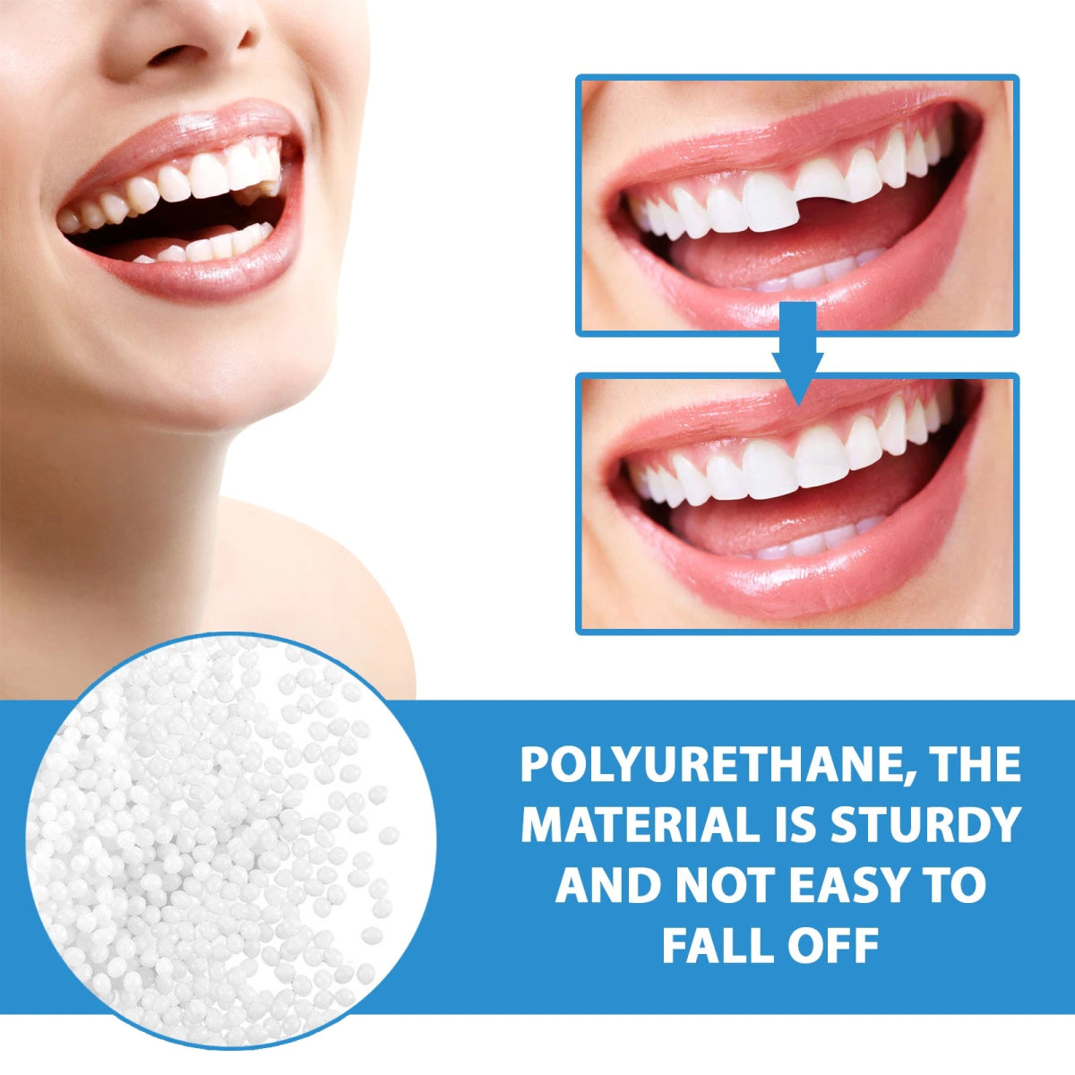 (1+1 FREE) SmileFix™ Moldable Temporary Tooth Repair Kit - VERRANOO