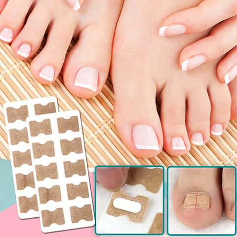 PainFree® | Nail Correction Patches - Free Protected Shipping! - Coolpho