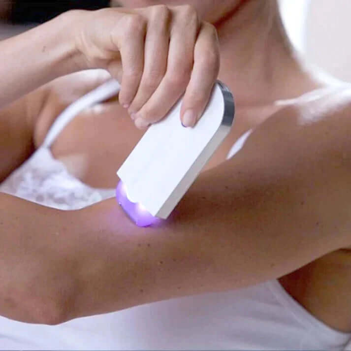 50% + Free Shipping | SkinSmoth Laser Epilator - VERRANOO