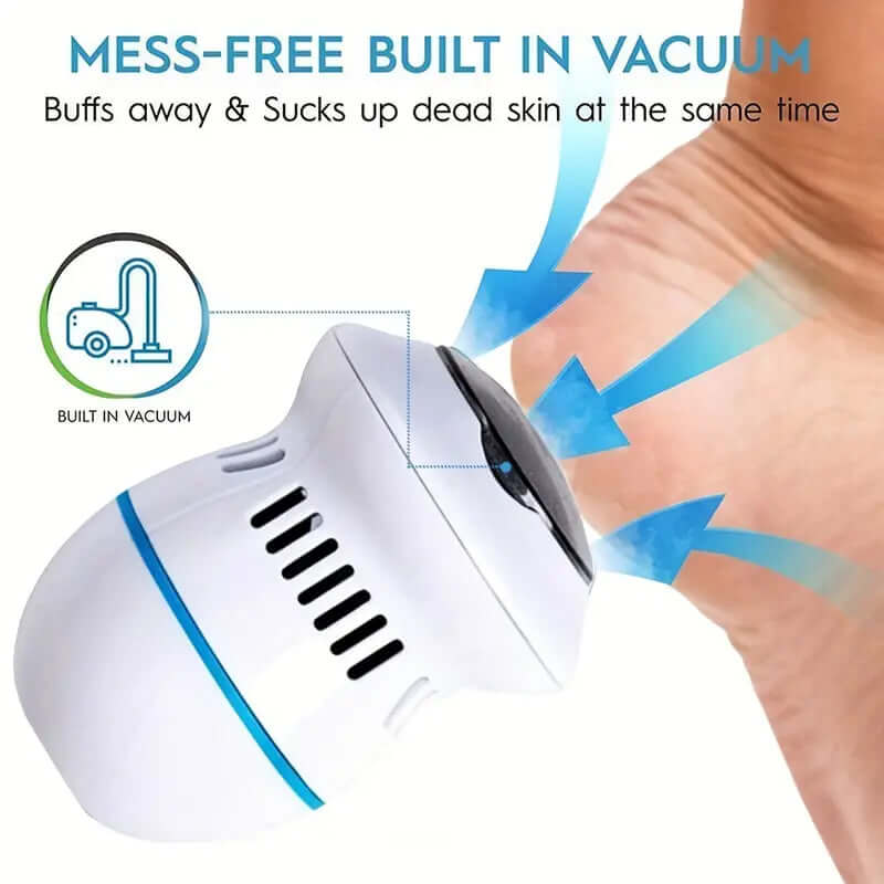 BeautyFeet™ | Electric Foot Grinder - 50% OFF THIS WEEK ONLY! - VERRANOO