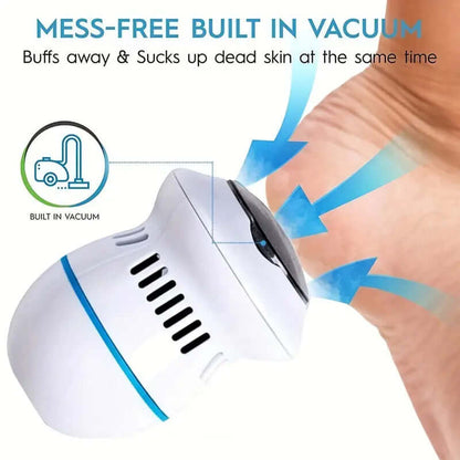 BeautyFeet™ | Electric Foot Grinder - 50% OFF THIS WEEK ONLY! - VERRANOO