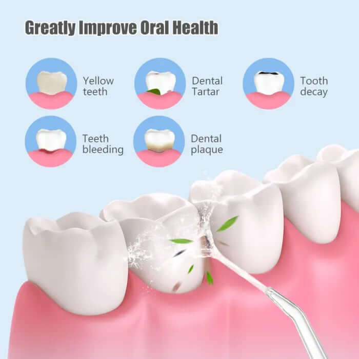 FlossClean™ Dental Water Flosser - VERRANOO