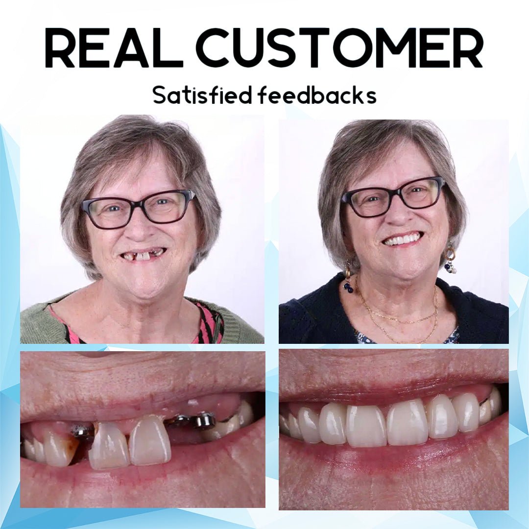 SmileRevive Pro – Transform Your Smile with Our Silicone Reline Denture Set - VERRANOO