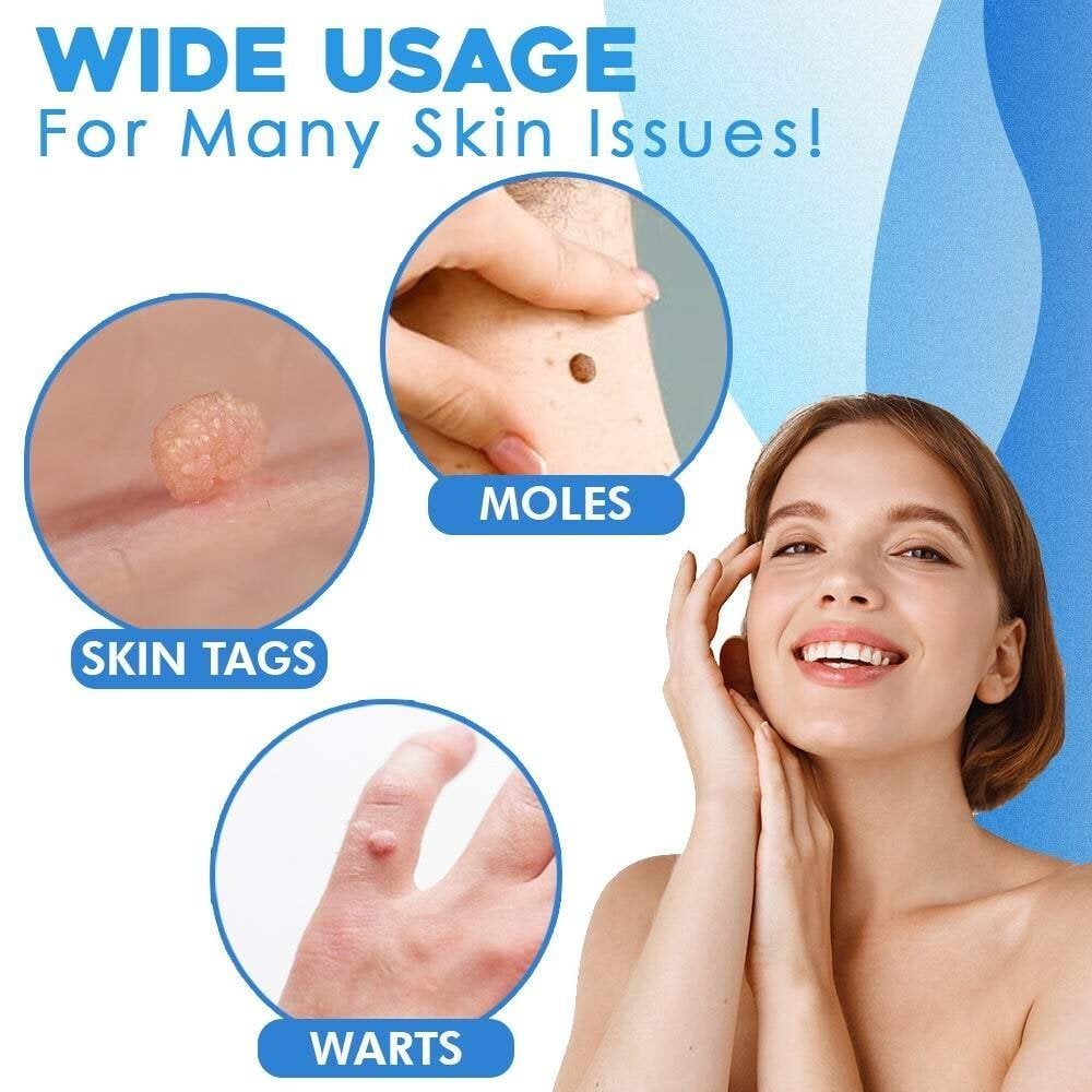 TagAway Pro – Fast, Painless Skin Tag Removal Kit - VERRANOO