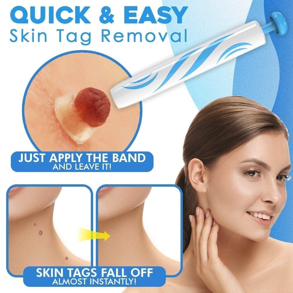 TagAway Pro – Fast, Painless Skin Tag Removal Kit - VERRANOO