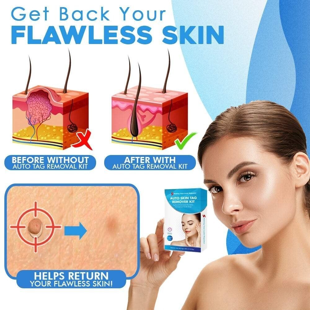 TagAway Pro – Fast, Painless Skin Tag Removal Kit - VERRANOO